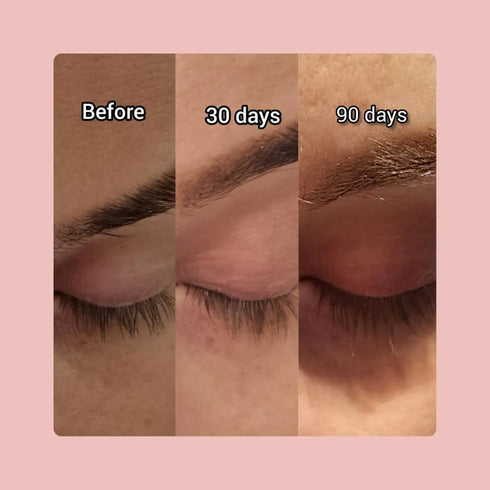 FYNE Eyelash Enhancing Serum